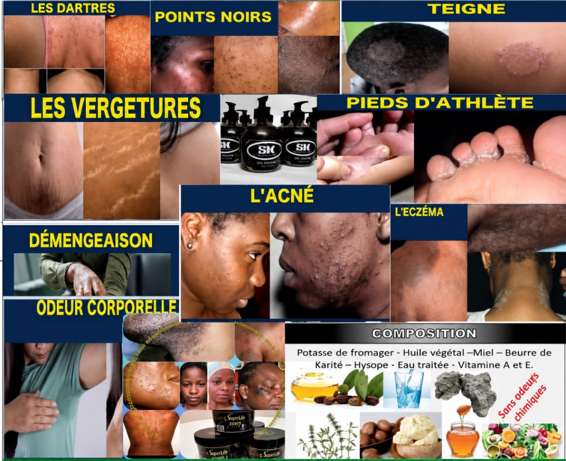 Savon 🧼 Noir